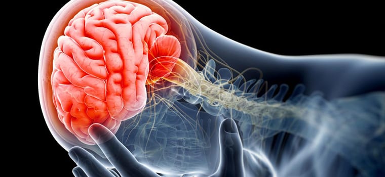 760x350 Doc Blog Brain Injury